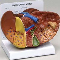 Diseased Liver Pharmaceutical and Anatomical Model Gifts